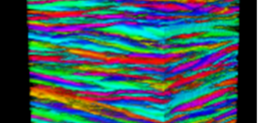 Cartographier la structure de la cornée humaine