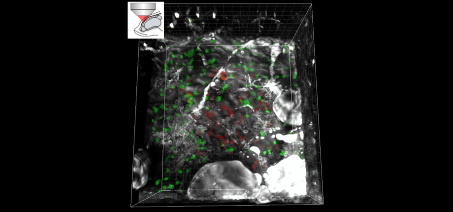 3-photon microscopy for deep-tissue imaging