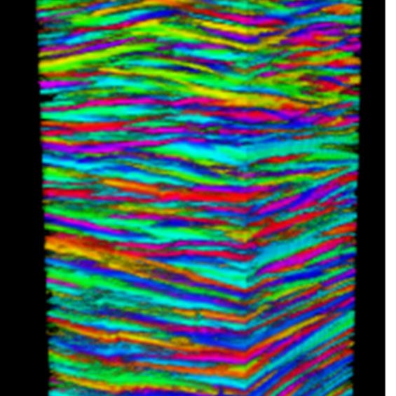 Cartographier la structure de la cornée humaine