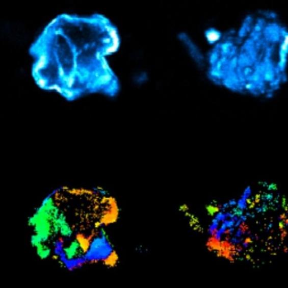 Imagerie multiphoton des calculs rénaux