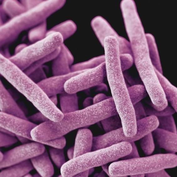 Des défauts dans les gènes de réparation de l’ADN favorisent l’émergence de la résistance aux antimicrobiens chez Mycobacterium tuberculosis