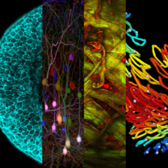 Microscopies avancées