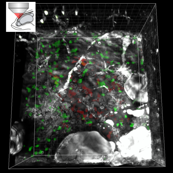 3-photon microscopy for deep-tissue imaging