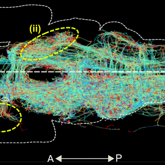 Large-volume bioimage informatics