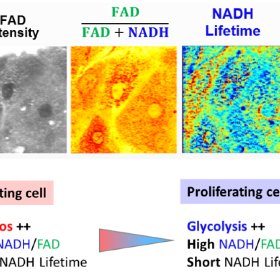 FLIM-based metabolic imaging