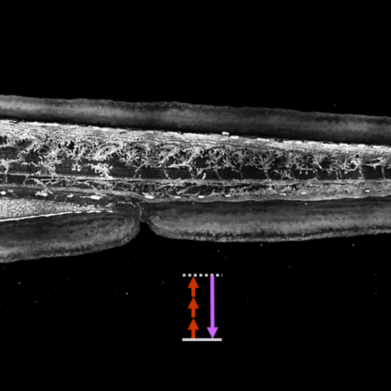 Label-free THG microscopy